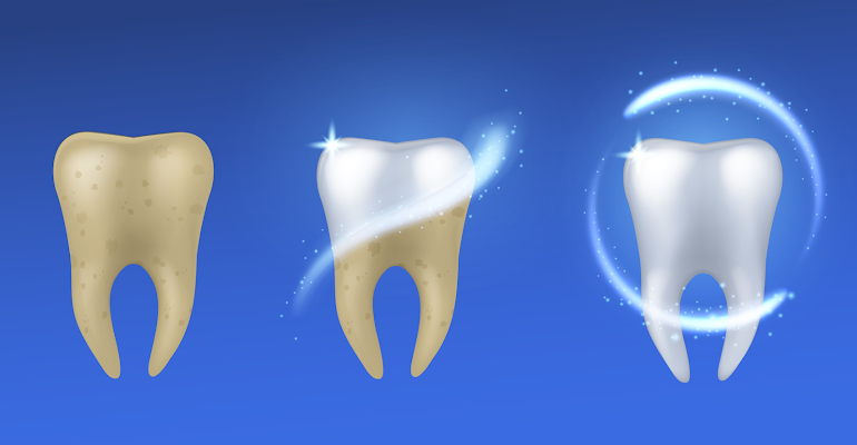 Is Your Smile Guest-Ready? Let Us Help You Shine This Holiday.